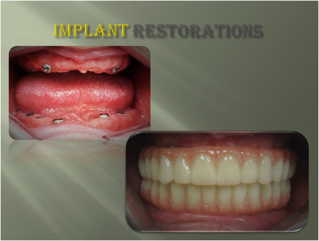 Before and After Case #3 Photo