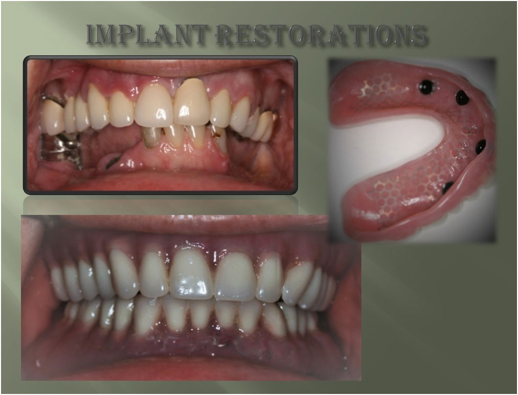 Before and After Case #7 Photo